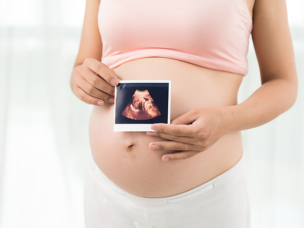 Ultrasound scan